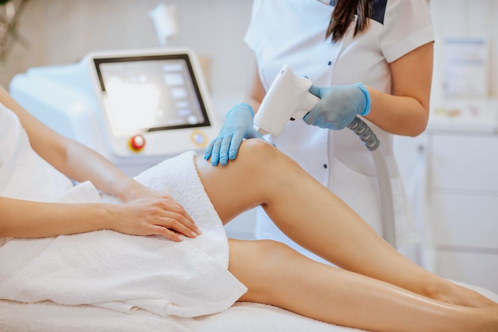 Laser Epilation