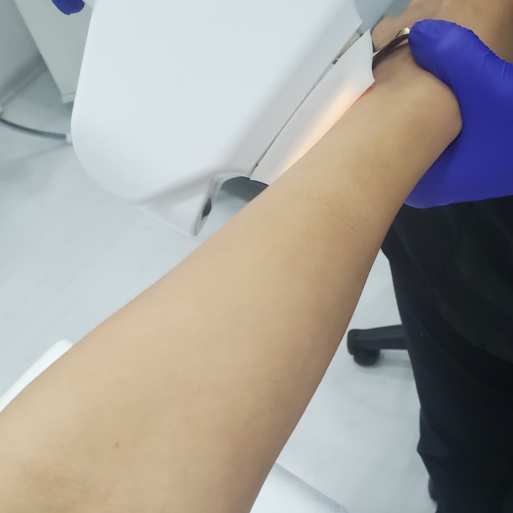Epiyes Aesthetic Laser Hair Removal