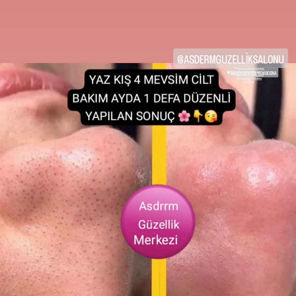 ASDERM GÜZELLİK SALONU Bahçelievler/Yenibosna /İstanbul