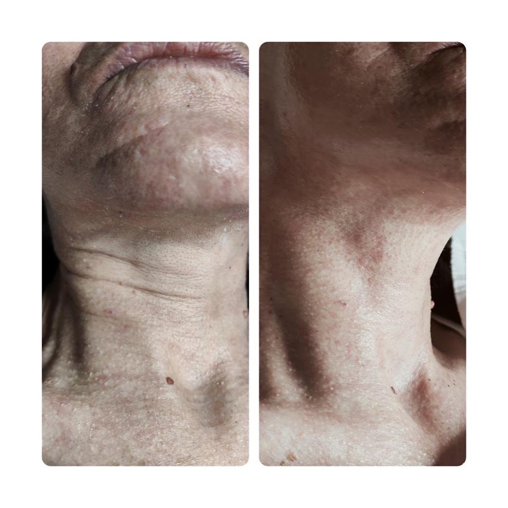 Nevam Güzellik Salonu Beylikdüzü (İğneli ve Cımbızlı Acısız Epilasyon, Medikal ve Profesyonel Cilt Bakımı, Microblading )